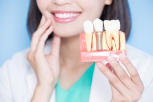 smiling dentist holds model jaw with dental implants in San Marcos