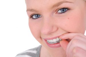 Invisalign in San Marcos is the perfect alternative to traditional braces.