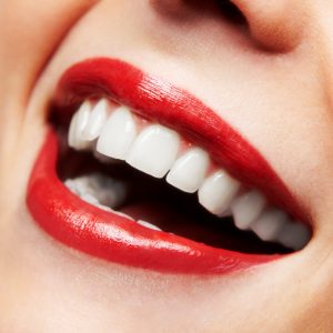 Cosmetic dentist, J. Robert Donnelly, offers San Marcos porcelain veneers. Artistically crafted, veneers disguise imperfections for a great, new smile.