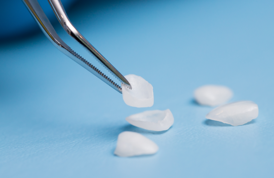 Close up of veneers on forceps