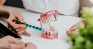 Dentist pointing at dental implants on a dental model
