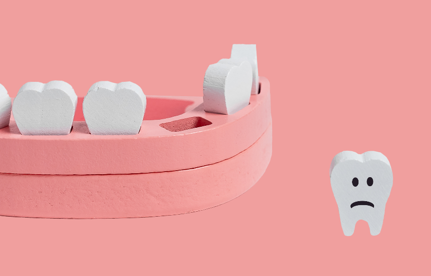 Model cartoon teeth with one knocked out of model jaw. The knocked out tooth has a frowny face.